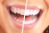 6 thói quen chăm sóc răng miệng sai lầm